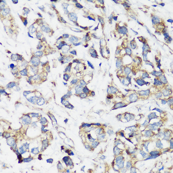 Immunohistochemistry - ELP3 Polyclonal Antibody 