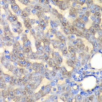 Immunohistochemistry - FAH Polyclonal Antibody 
