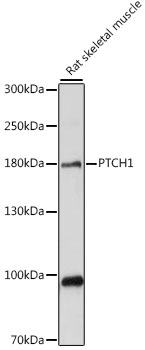 Western blot - PTCH1 Polyclonal Antibody 