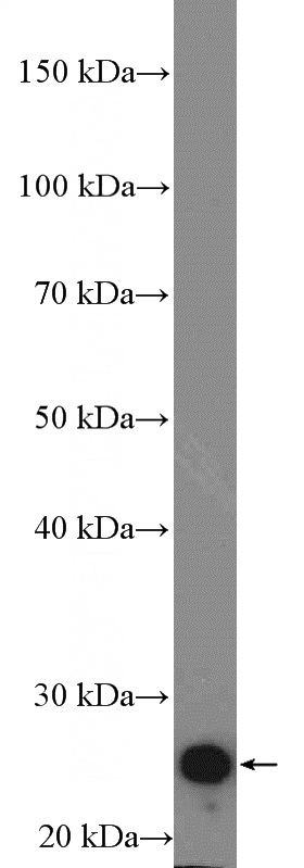 rat heart tissue were subjected to SDS PAGE followed by western blot with Catalog No:108859(TNNI3 Antibody) at dilution of 1:3000