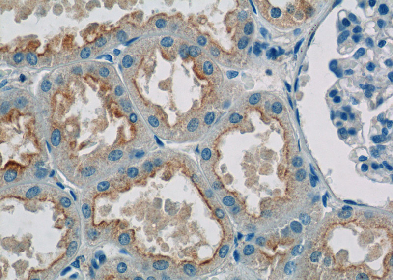 Immunohistochemistry of paraffin-embedded human kidney tissue slide using Catalog No:115447(SNAP29 Antibody) at dilution of 1:50 (under 40x lens)