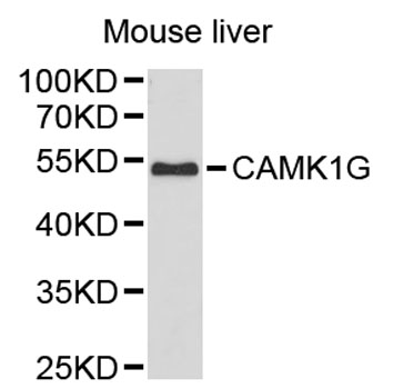 Western blot - CAMK1G Polyclonal Antibody 
