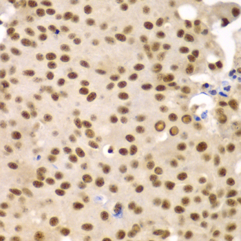 Immunohistochemistry - SF3B2 Polyclonal Antibody 