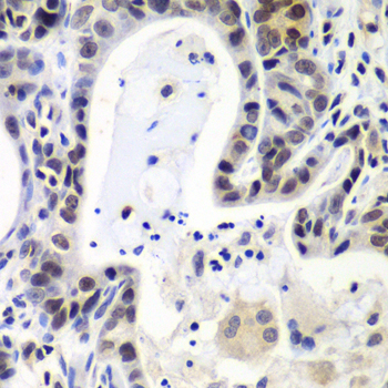 Immunohistochemistry - LSM2 Polyclonal Antibody 