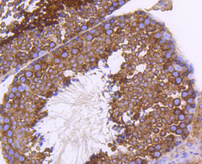 Immunohistochemistry - EGLN2 Monoclonal Antibody 
