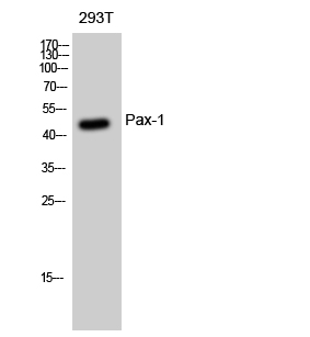 Fig1:; Western Blot analysis of 293T cells using Pax-1 Polyclonal Antibody diluted at 1: 500 cells nucleus extracted by Minute TM Cytoplasmic and Nuclear Fractionation kit (SC-003,Inventbiotech,MN,USA).