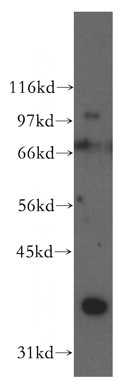 mouse testis tissue were subjected to SDS PAGE followed by western blot with Catalog No:109874(DAZL antibody) at dilution of 1:400