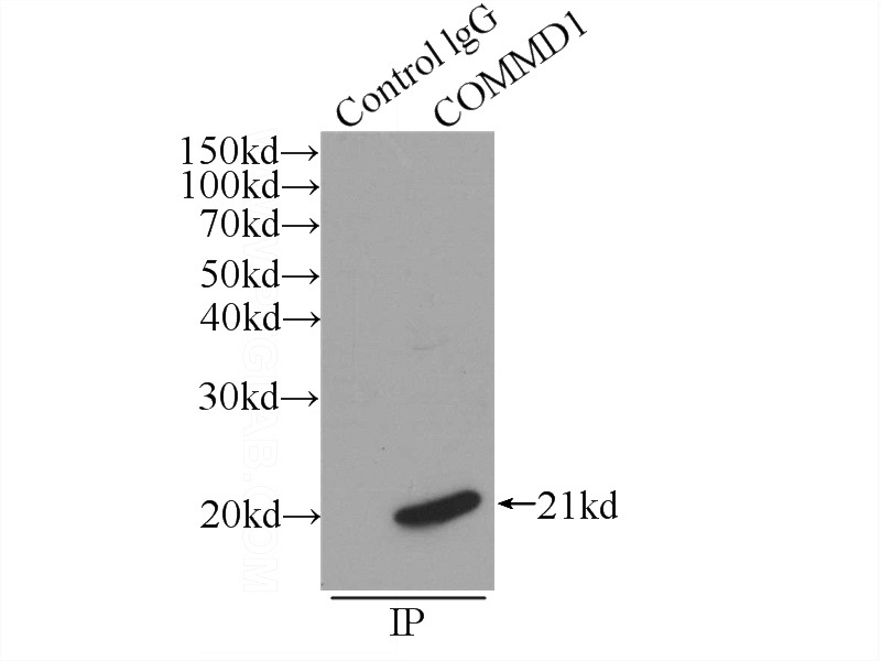 IP Result of anti-COMMD1 (IP:Catalog No:109443, 3ug; Detection:Catalog No:109443 1:500) with mouse brain tissue lysate 5200ug.
