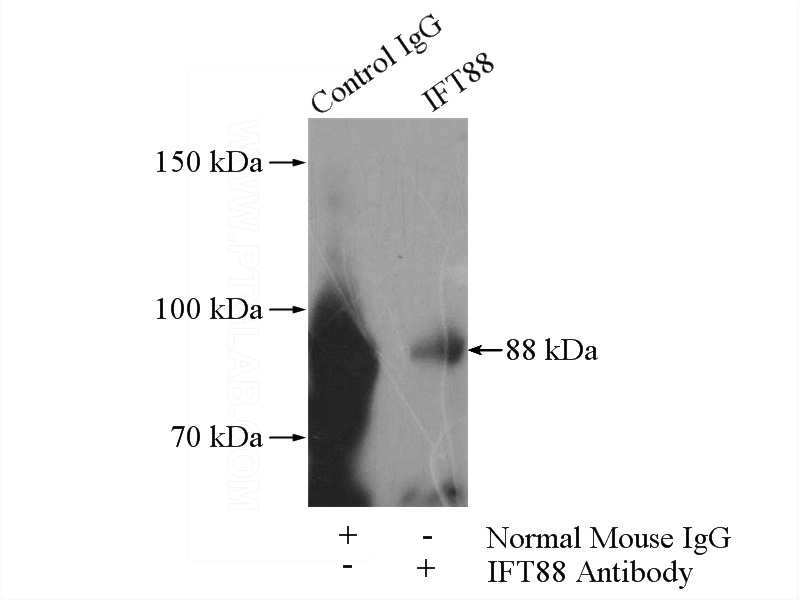 IP Result of anti-IFT88 (IP:Catalog No:107278, 5ug; Detection:Catalog No:107278 1:800) with PC-3 cells lysate 1040ug.