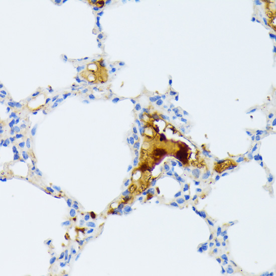 Immunohistochemistry - CTRB1 Polyclonal Antibody 