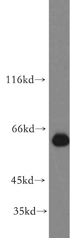 Jurkat cells were subjected to SDS PAGE followed by western blot with Catalog No:117024(ZNF703 antibody) at dilution of 1:500