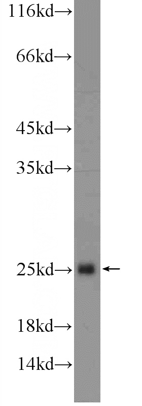 mouse liver tissue were subjected to SDS PAGE followed by western blot with Catalog No:111361(HIST1H3D Antibody) at dilution of 1:300