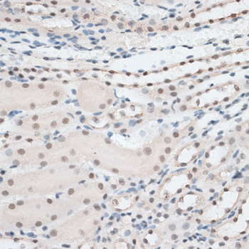 Immunohistochemistry - AQR Polyclonal Antibody 