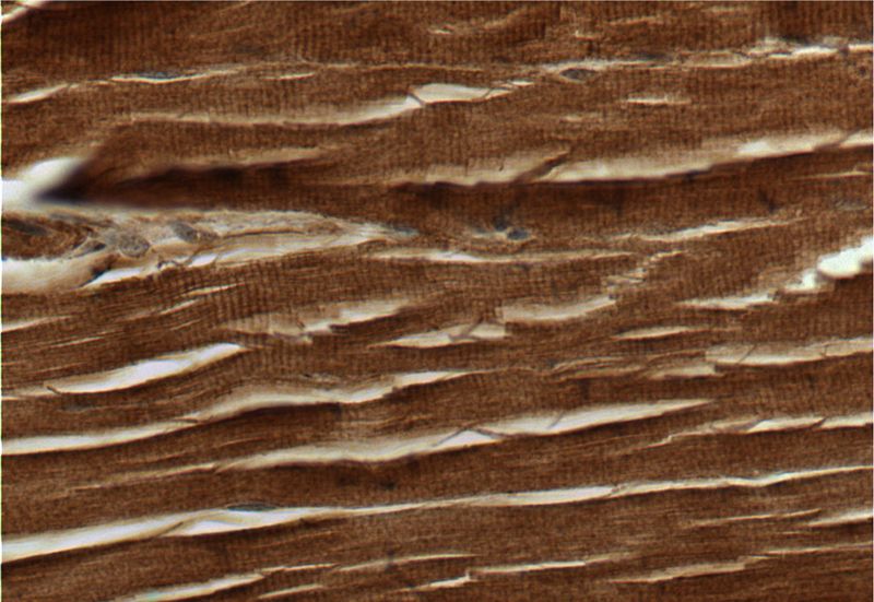 Immunohistochemistry of paraffin-embedded human skeletal muscle tissue slide using Catalog No:108875(Caspase 3 Antibody) at dilution of 1:50 (under 40x lens)
