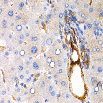 Immunohistochemistry - TFF1 Polyclonal Antibody 
