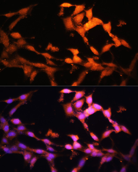 Immunofluorescence - FLCN Polyclonal Antibody 