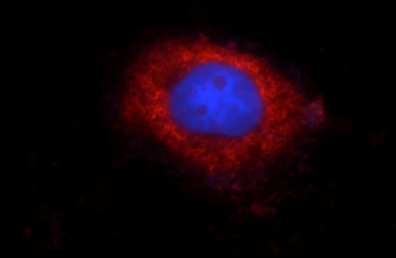 Immunofluorescent analysis of MCF-7 cells using Catalog No:115279(PTPN6 Antibody) at dilution of 1:25 and Rhodamine-Goat anti-Rabbit IgG