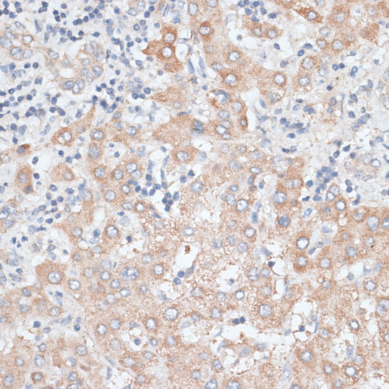 Immunohistochemistry - GPC4 Polyclonal Antibody 