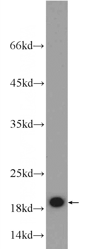 HeLa cells were subjected to SDS PAGE followed by western blot with Catalog No:108243(ARF1 antibody) at dilution of 1:1000