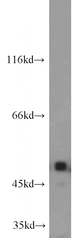 mouse heart tissue were subjected to SDS PAGE followed by western blot with Catalog No:111752(ILK antibody) at dilution of 1:1000
