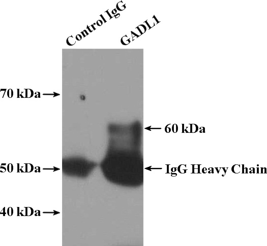 IP Result of anti-GADL1 (IP:Catalog No:110823, 4ug; Detection:Catalog No:110823 1:300) with mouse brain tissue lysate 4000ug.