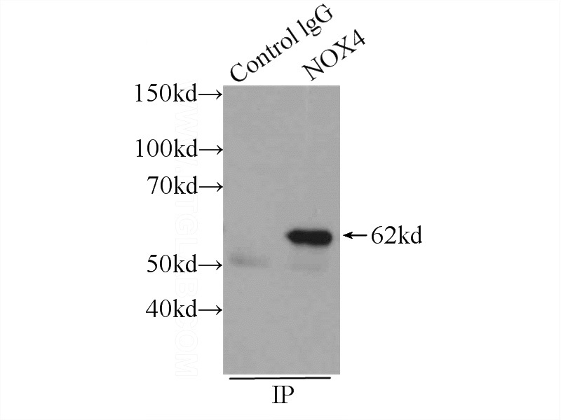 IP Result of anti-NOX4 (IP:Catalog No:113314, 3ug; Detection:Catalog No:113314 1:1000) with HEK-293 cells lysate 1700ug.