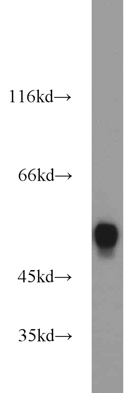 mouse liver tissue were subjected to SDS PAGE followed by western blot with Catalog No:112492(MAT1A antibody) at dilution of 1:1000