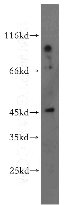 human brain tissue were subjected to SDS PAGE followed by western blot with Catalog No:114032(PNCK antibody) at dilution of 1:300