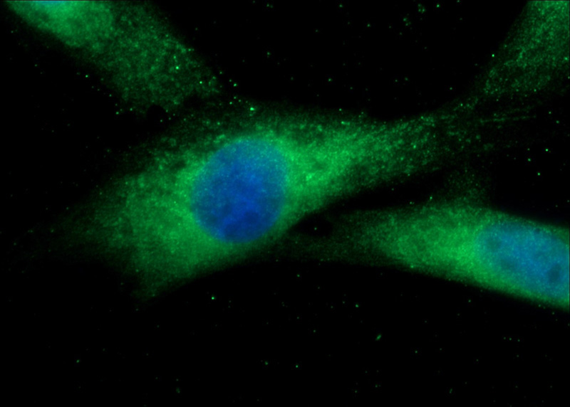 Immunofluorescent analysis of MDCK cells using Catalog No:114540(RANBP9 Antibody) at dilution of 1:50 and Alexa Fluor 488-congugated AffiniPure Goat Anti-Rabbit IgG(H+L)