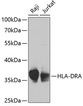 Western blot - HLA-DRA Polyclonal Antibody 