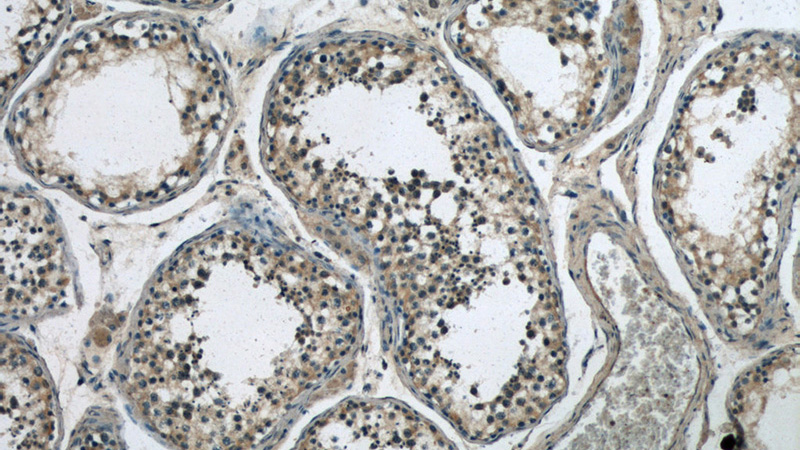 Immunohistochemistry of paraffin-embedded human testis slide using Catalog No:116627(UPF3B Antibody) at dilution of 1:50