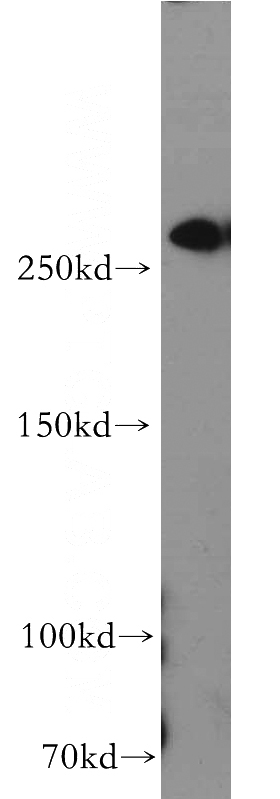 HeLa cells were subjected to SDS PAGE followed by western blot with Catalog No:110690(FLNB antibody) at dilution of 1:300