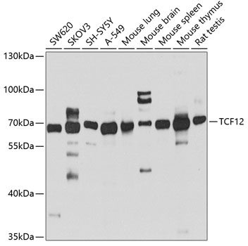 Western blot - TCF12 Polyclonal Antibody 