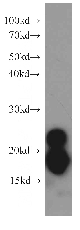 human colon tissue were subjected to SDS PAGE followed by western blot with Catalog No:107640(TAGLN antibody) at dilution of 1:1000