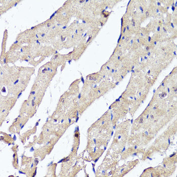Immunohistochemistry - ACSS2 Polyclonal Antibody 