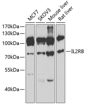 Western blot - IL2RB Polyclonal Antibody 