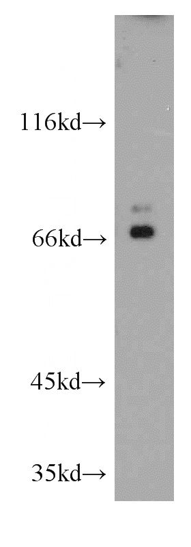 RAW264.7 cells were subjected to SDS PAGE followed by western blot with Catalog No:110424(EZH1 antibody) at dilution of 1:300
