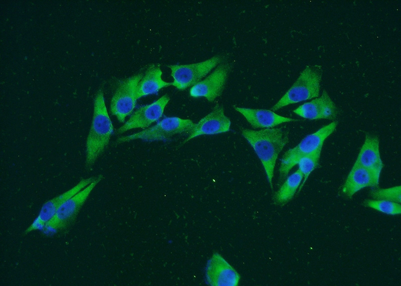 Immunofluorescent analysis of A375 cells using Catalog No:114916(RPS8 Antibody) at dilution of 1:50 and Alexa Fluor 488-congugated AffiniPure Goat Anti-Rabbit IgG(H+L)