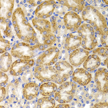 Immunohistochemistry - BMP15 Polyclonal Antibody 