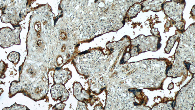 Immunohistochemical of paraffin-embedded human placenta using Catalog No:109034(ENTPD1 antibody) at dilution of 1:50 (under 10x lens)