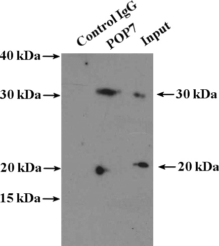 IP Result of anti-POP7 (IP:Catalog No:114062, 4ug; Detection:Catalog No:114062 1:500) with HeLa cells lysate 3200ug.