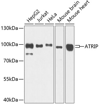 Western blot - ATRIP Polyclonal Antibody 