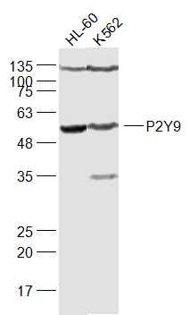 Fig6: Sample:; HL-60(Human) Cell Lysate at 30 ug; K562(Human) Cell Lysate at 30 ug; Primary: Anti-P2Y9 at 1/1000 dilution; Secondary: IRDye800CW Goat Anti-Rabbit IgG at 1/20000 dilution; Predicted band size: 42 kD; Observed band size: 57 kD