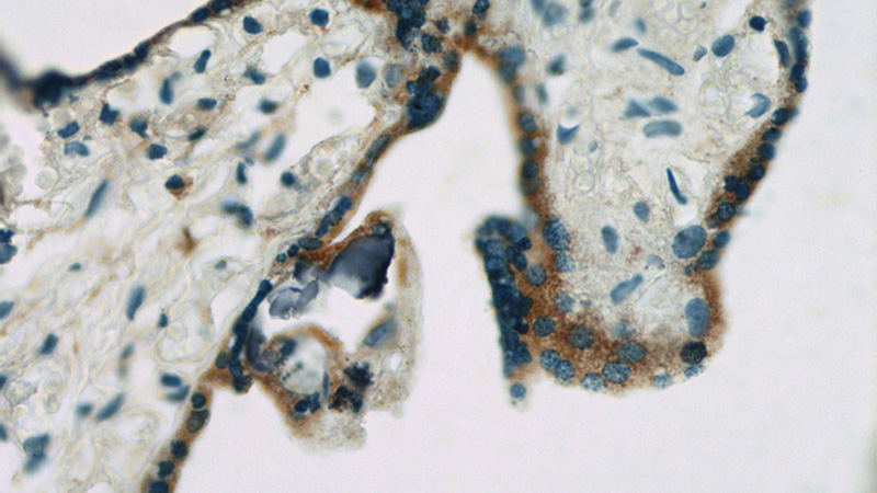 Immunohistochemistry of paraffin-embedded human placenta slide using Catalog No:107697(ACSL4 Antibody) at dilution of 1:50