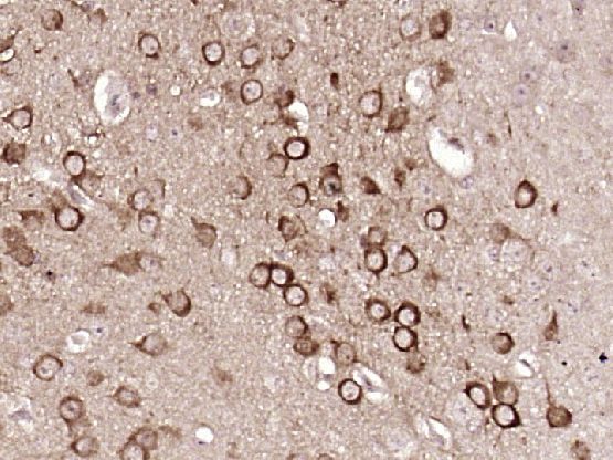 Fig3: Paraformaldehyde-fixed, paraffin embedded (Mouse brain); Antigen retrieval by boiling in sodium citrate buffer (pH6.0) for 15min; Block endogenous peroxidase by 3% hydrogen peroxide for 20 minutes; Blocking buffer (normal goat serum) at 37℃ for 30min; Antibody incubation with (5HT2A Receptor) Polyclonal Antibody, Unconjugated at 1:400 overnight at 4℃, followed by operating according to SP Kit(Rabbit) (sp-0023) instructionsand DAB staining.