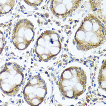 Immunohistochemistry - IFI44 Polyclonal Antibody 