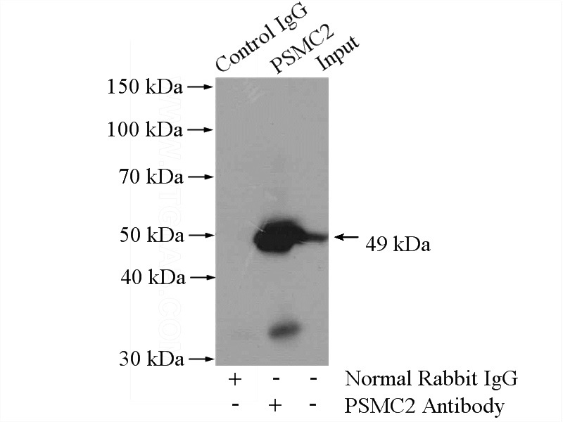 IP Result of anti-PSMC2 (IP:Catalog No:114389, 4ug; Detection:Catalog No:114389 1:500) with mouse spleen tissue lysate 4800ug.