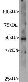 Fig1: Western blot analysis on recombinant protein of CELSR2 using anti- CELSR2 polyclonal antibody.