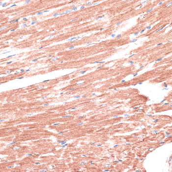 Immunohistochemistry - LMO4 Polyclonal Antibody 