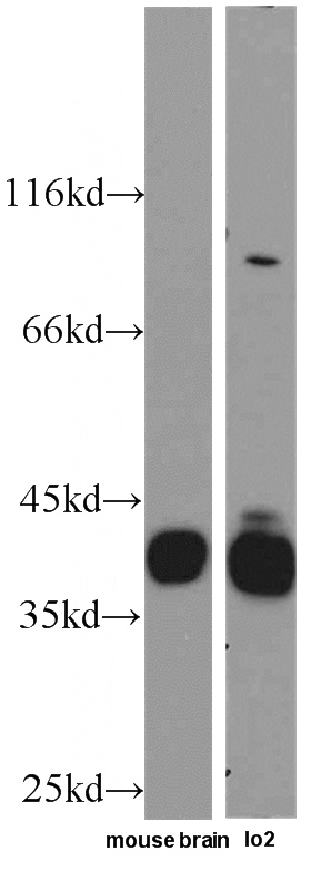 mouse brain tissue were subjected to SDS PAGE followed by western blot with Catalog No:112870(Musashi-2 antibody) at dilution of 1:500